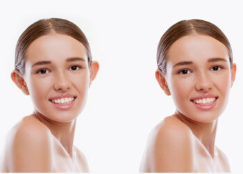 SOSYAL MEDYANIN YENİ ÇILGINLIĞI: KEPÇE KULAK BANTLARI