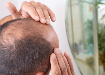 Saç Sağlığını Olumsuz Etkileyen Meslekler