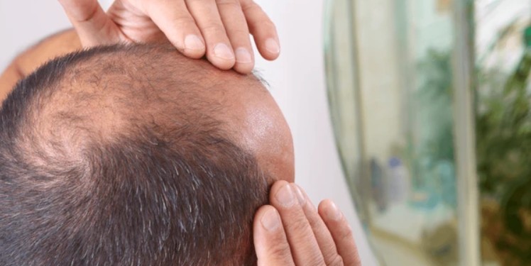 Saç Sağlığını Olumsuz Etkileyen Meslekler