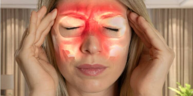 Sinüzite karşı doğal destek