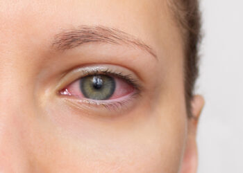 Bulaşıcı göz hastalıklarına dikkat!