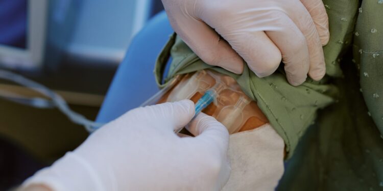 MS’de kök hücre umudu