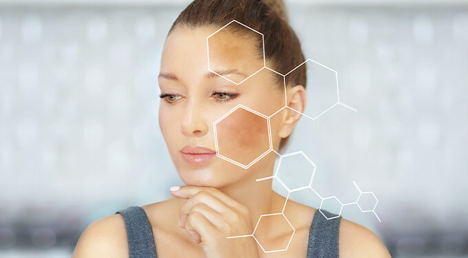 Cilt lekeleri sadece estetik bir sorun mu?