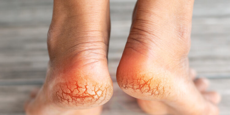 Ayaklarınızdaki sessiz alarm